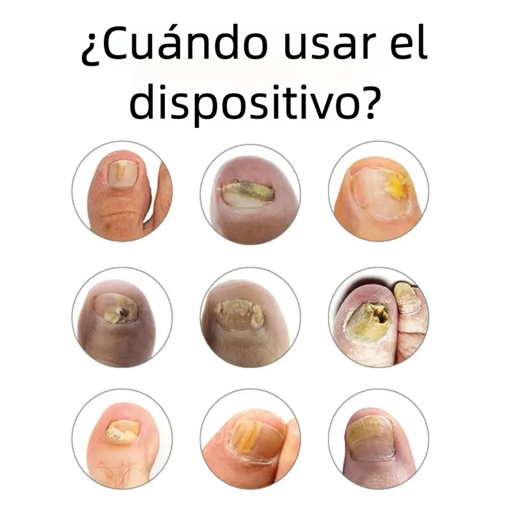 Aparato Antimicótico