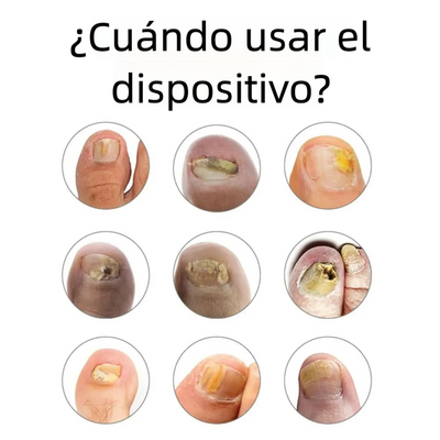 Aparato Antimicótico