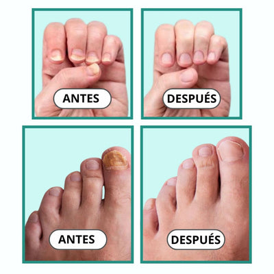 Aparato Antimicótico
